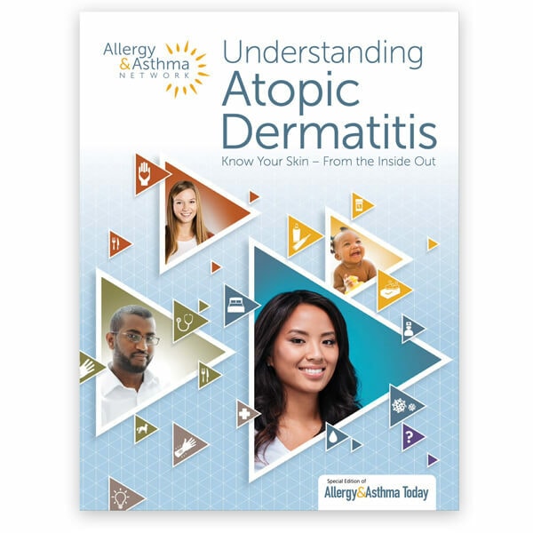 Understanding Atopic Dermatitis guide