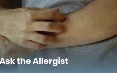 Ask the Allergist: Understanding the Causes of Hives and Angioedema