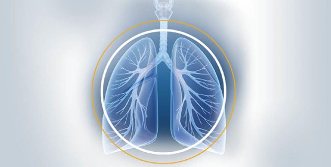 供研究的肺部图像