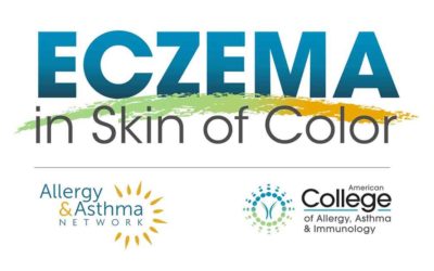 New Website Spotlights Unique Differences of Eczema In People of Color