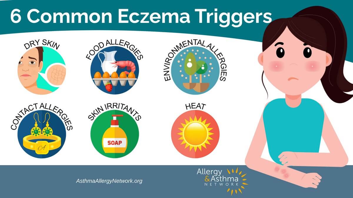 图6常见的湿疹触发:皮肤干燥,Food allergies, Contact allergies, Skin irritants, Environmental allergies, Heat