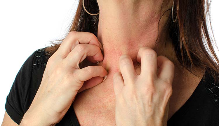 Woman vigorously scratching her neck with both hands