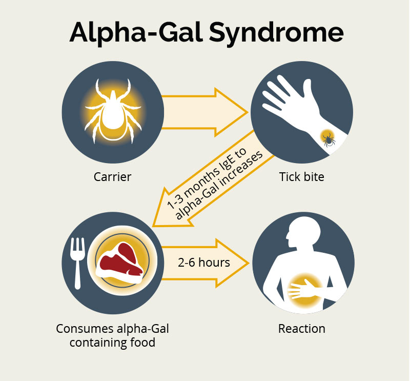 Chart of Alpha-gal syndrome progression from Tick to tick bite to consuming meat or milk to the reaction. This takes about 1-3 months for symptoms to appear.